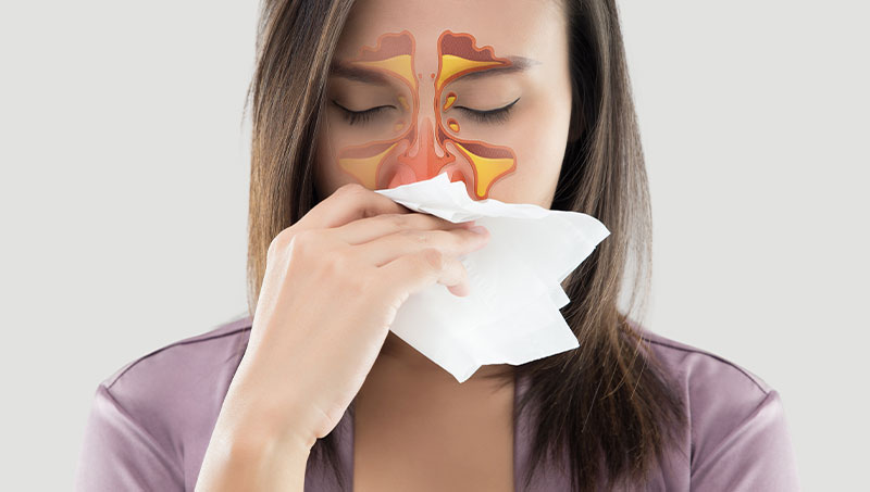 Woman with severe allergies